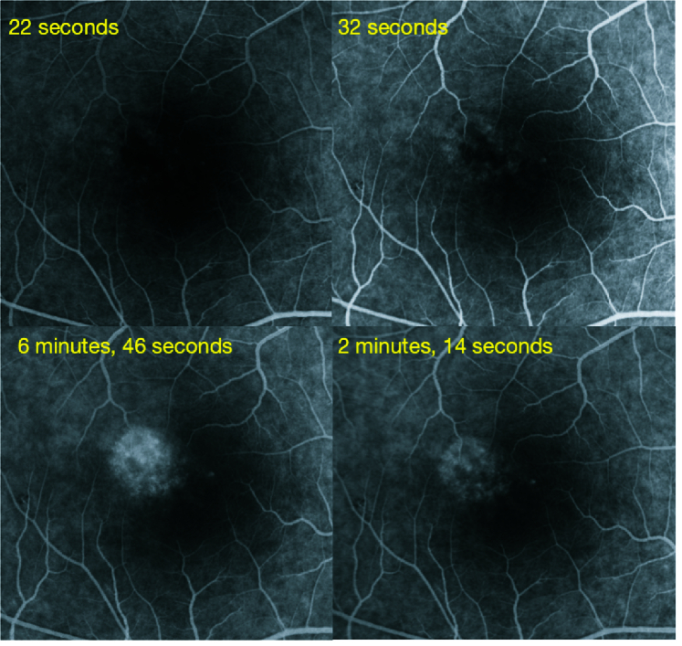 Figure 4