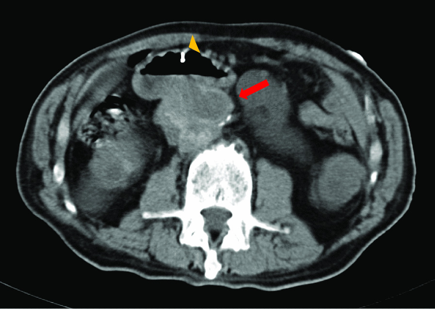 Fig. 10