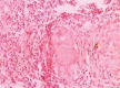 Figure 1c
