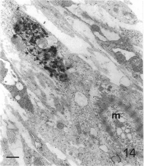 Fig. 14