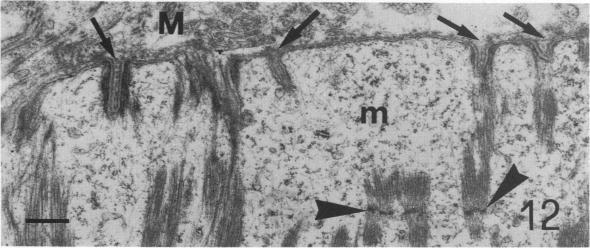 Fig. 12