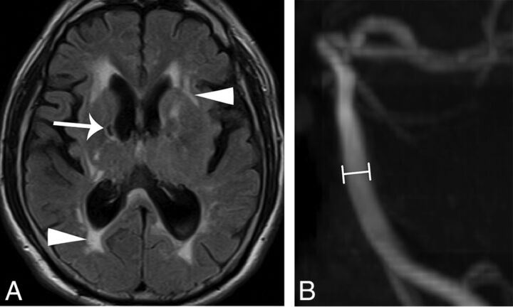 Fig 1.