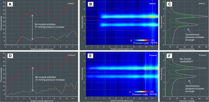 Figure 21