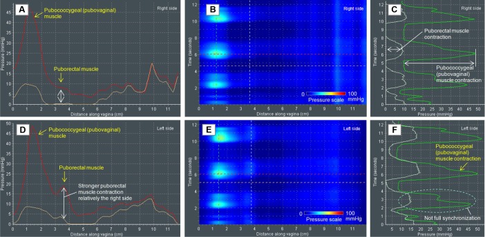 Figure 17