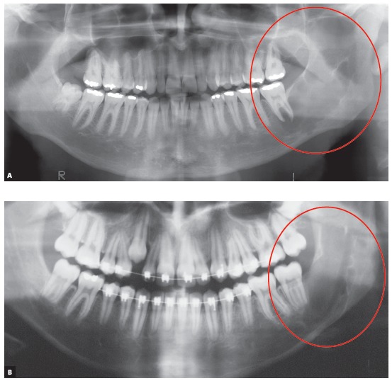 Figure 13