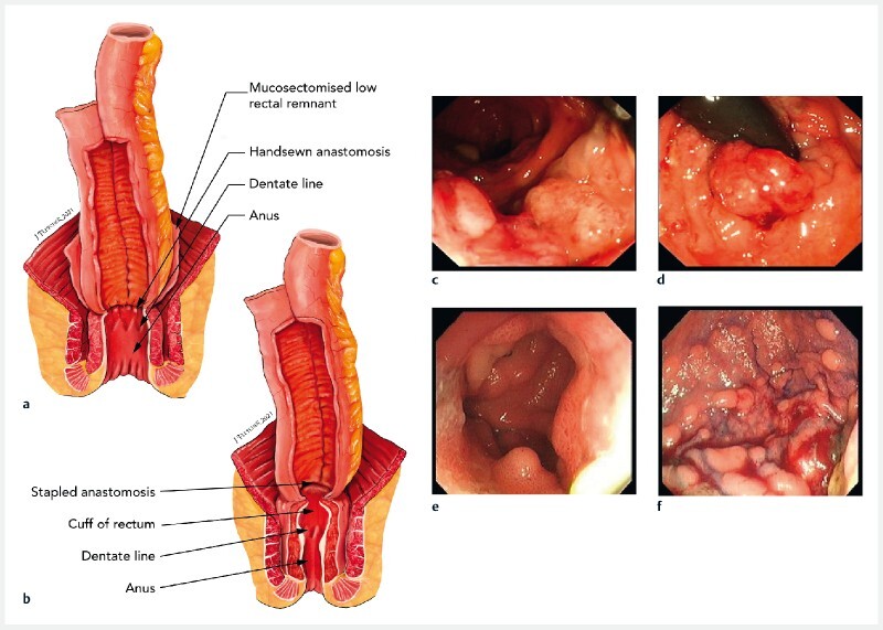 Fig. 1 