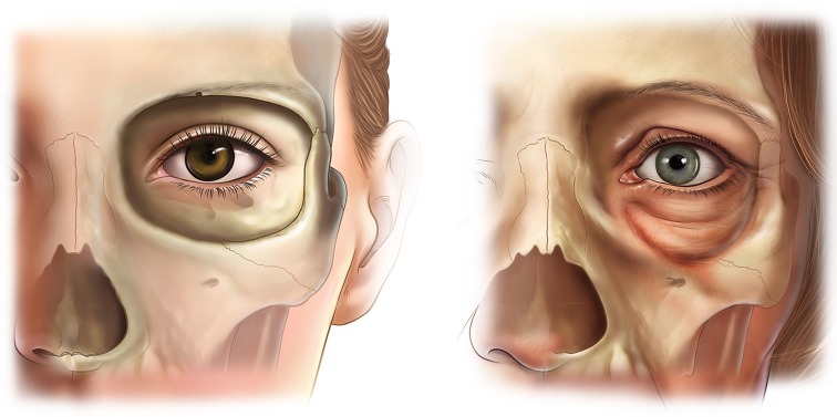 Fig. 1