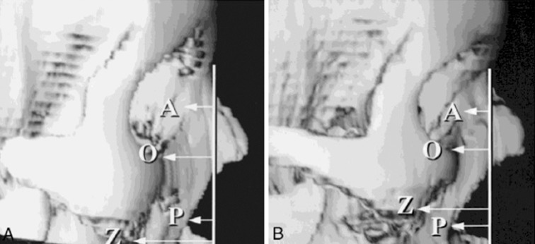 Fig. 3