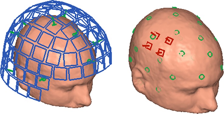 Fig 1