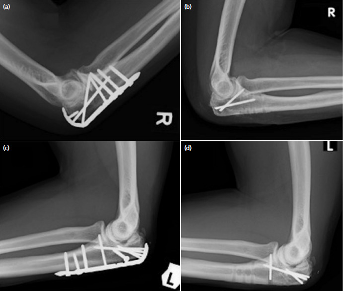 Fig. 2.