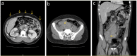 Fig 4