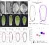The effects of giant cells on sepal shape (a) Scanning electron microscopy pictures of WT, pATML1::LGO (LGO), vip3-1 and vip3-1 pATML1::LGO (vip3-1 LGO) sepals