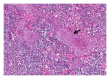 Figure 25