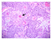 Figure 22