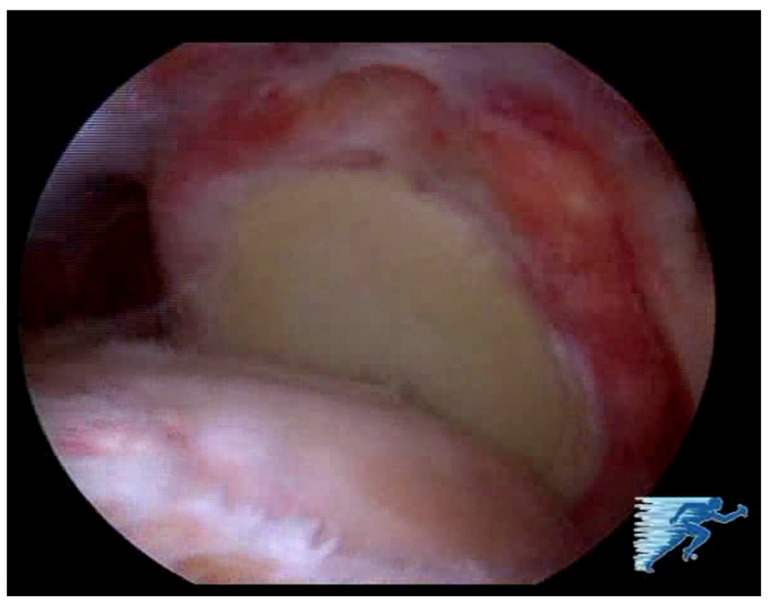 Fig. (5)