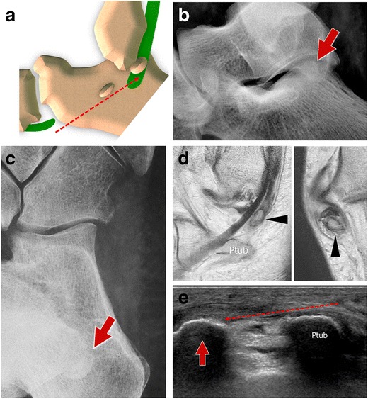 Fig. 15