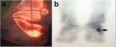 Fig. 10