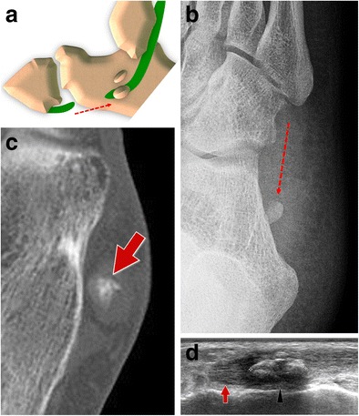 Fig. 14