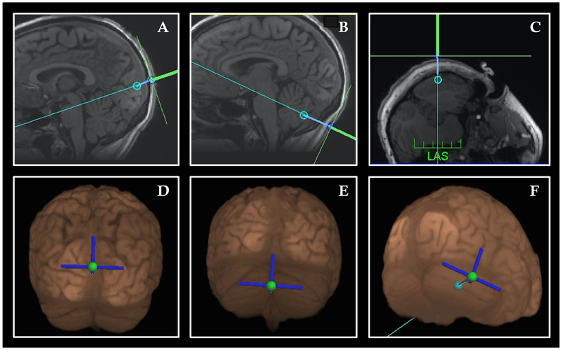 Figure 1: