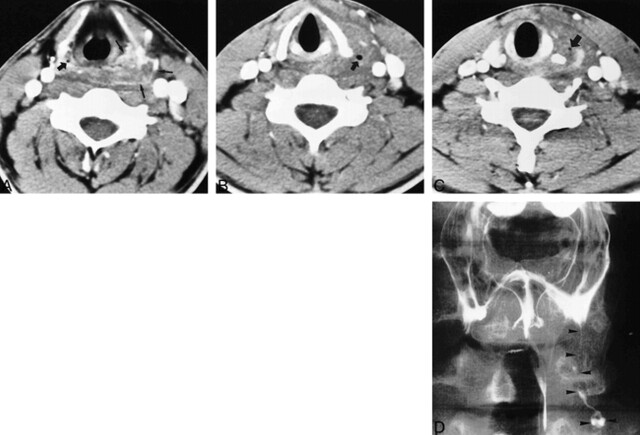 FIG 2.