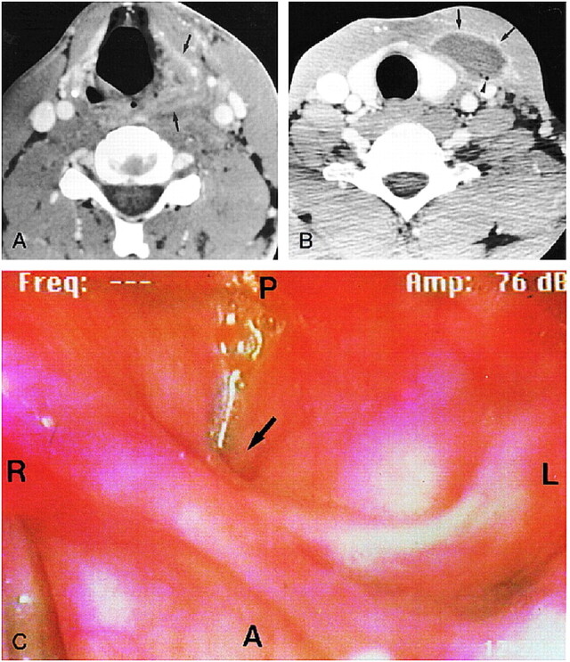 FIG 3.