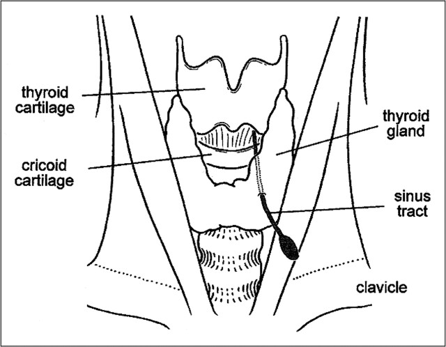 FIG 1.