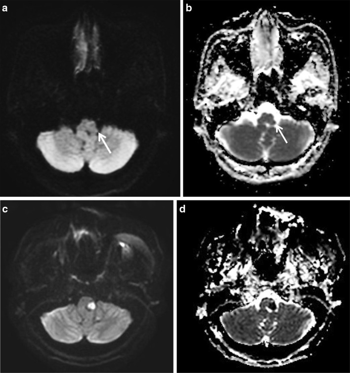 Fig. 4