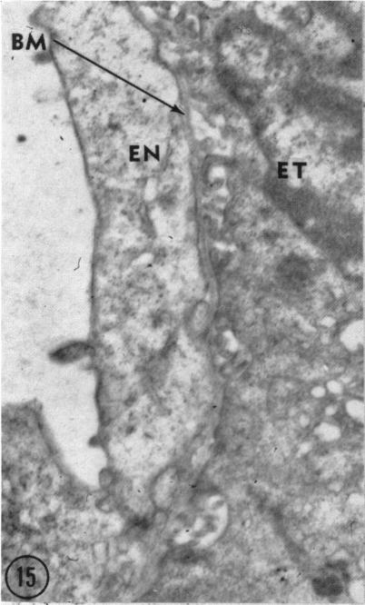 Fig. 15