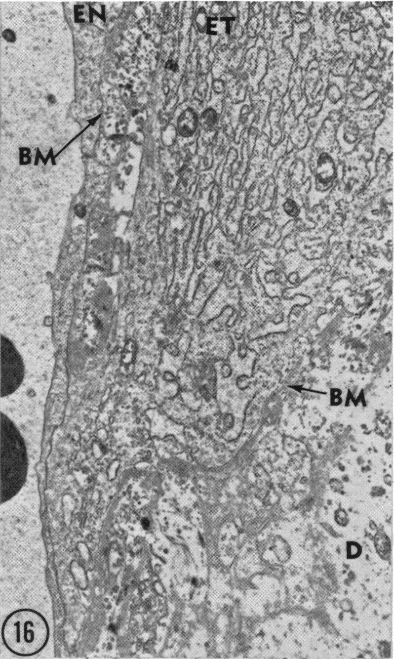 Fig. 16