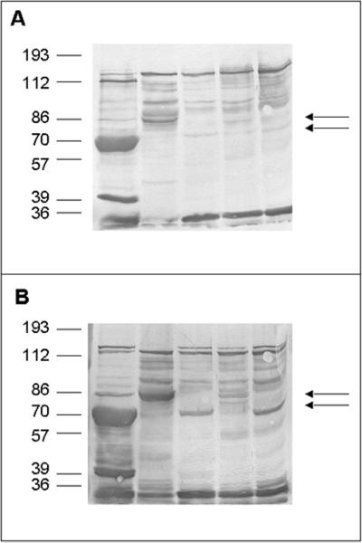 FIG. 1