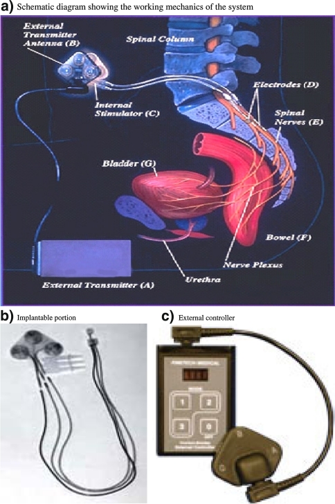 Fig. 3