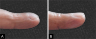 Fig 1: