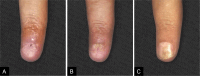 Fig 5: