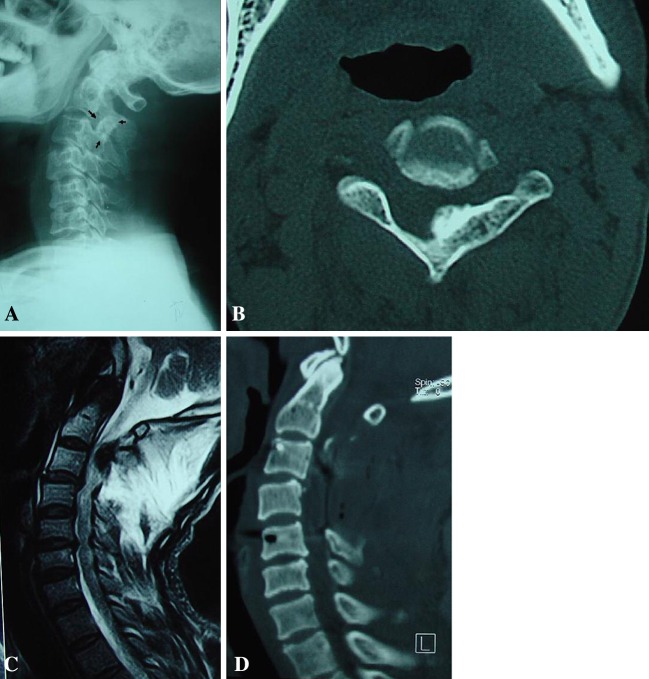 Fig. 2