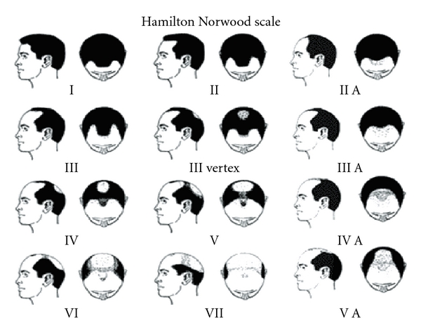 Figure 17