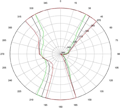 Figure 2(b)