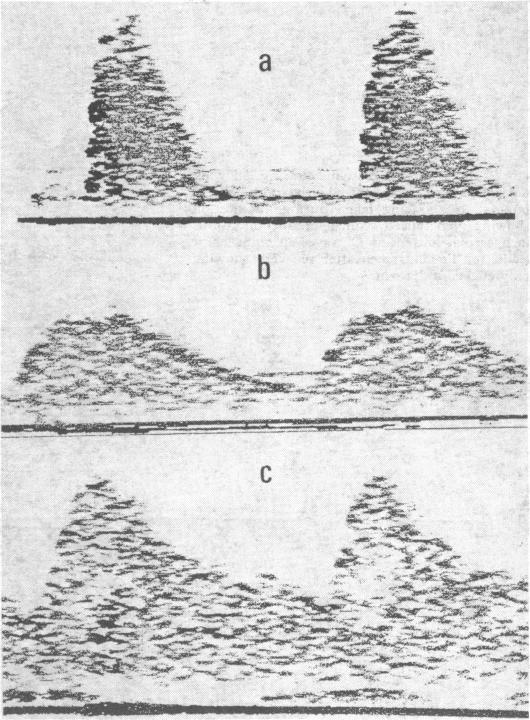 FIG 2