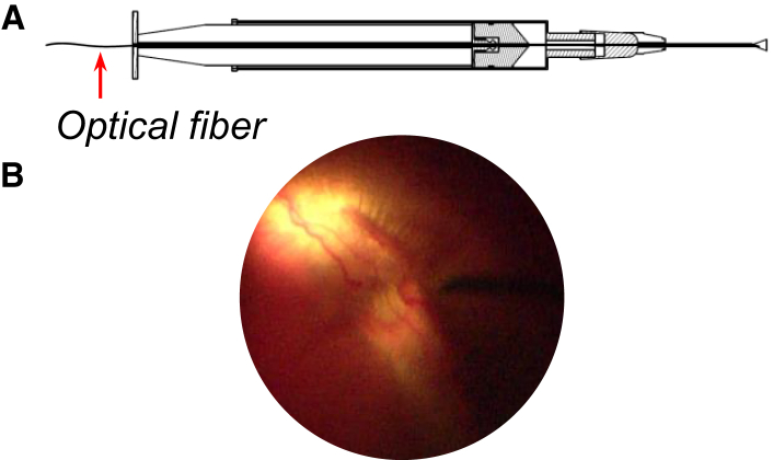 Figure 1