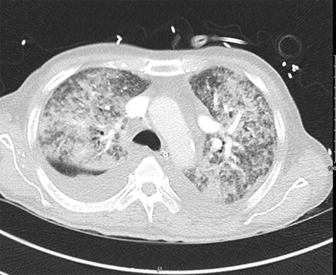 FIGURE 4