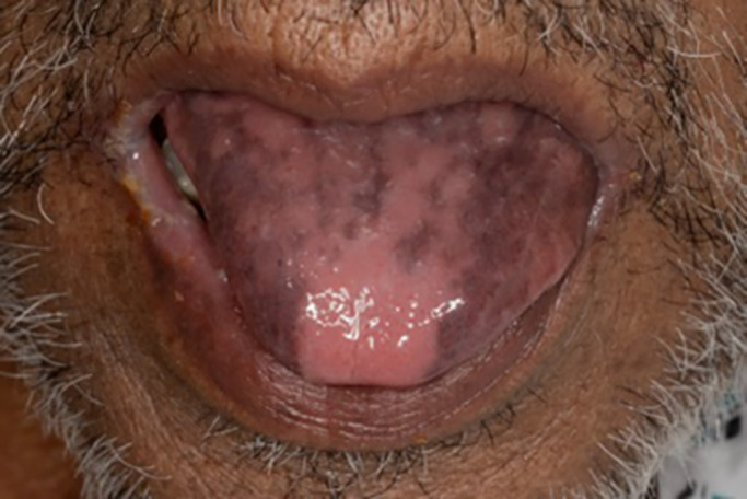 FIGURE 1