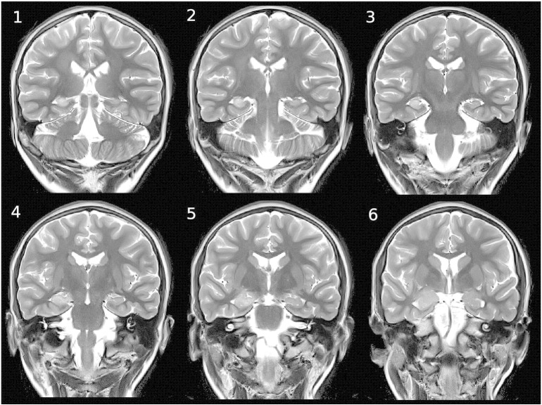 Fig. 2