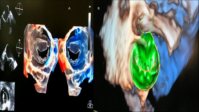 Figure 15