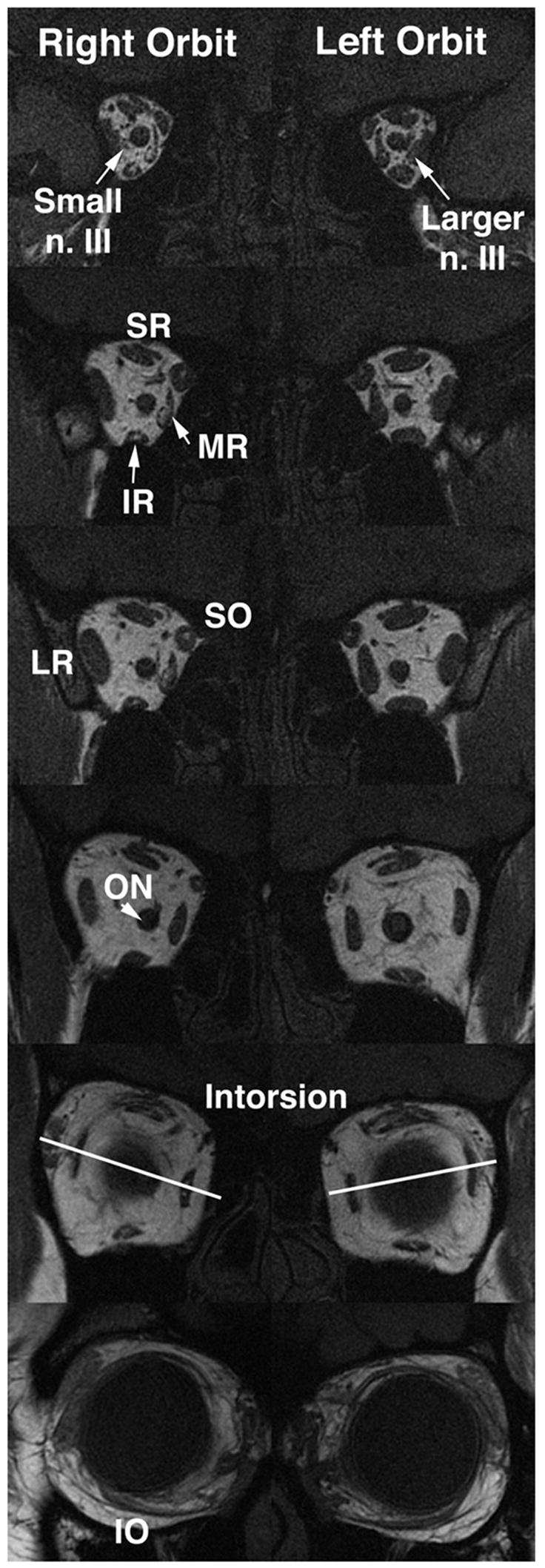 FIG 2