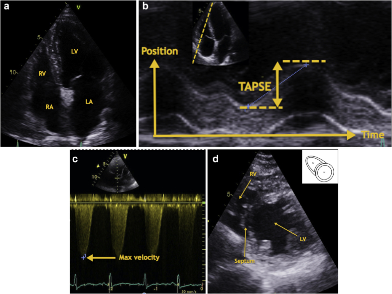 Fig 5