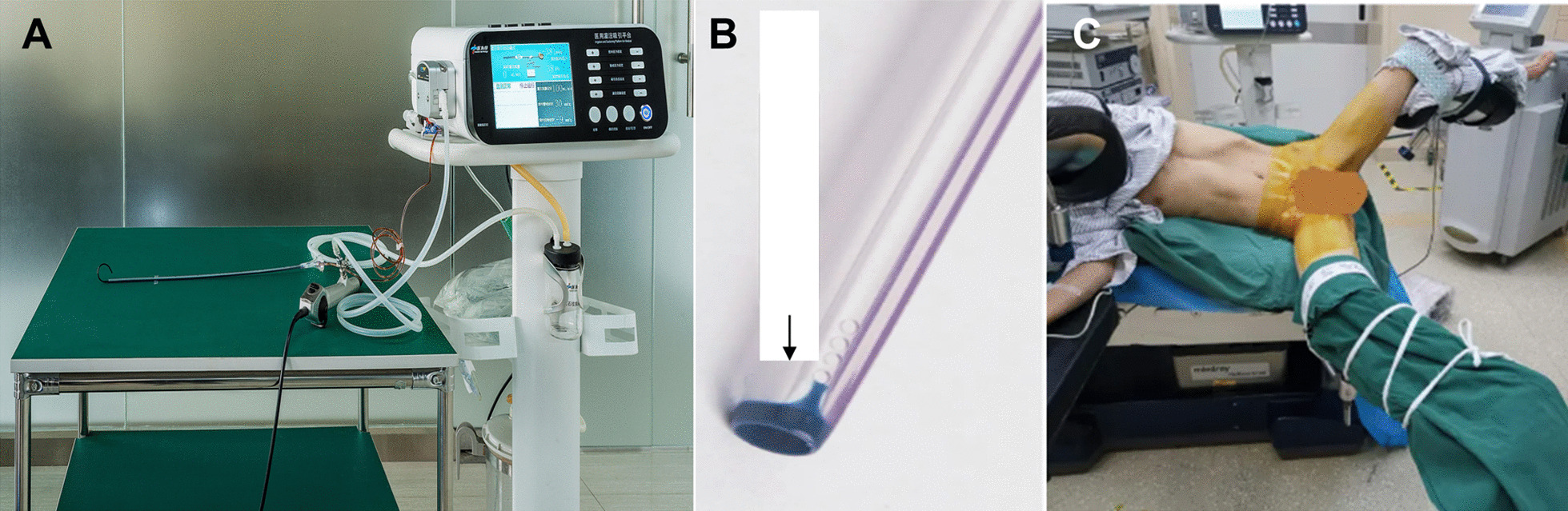 Fig. 1