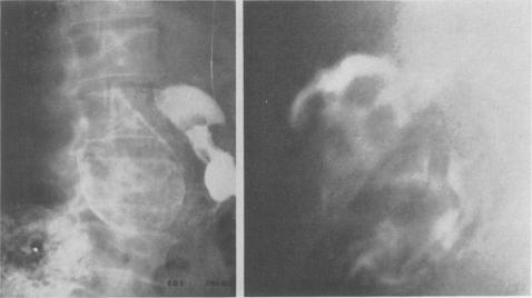 Fig. 1 (left)., Fig. 2 (right).