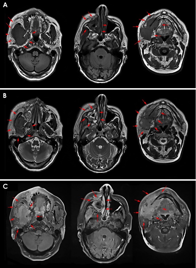 Fig. 4