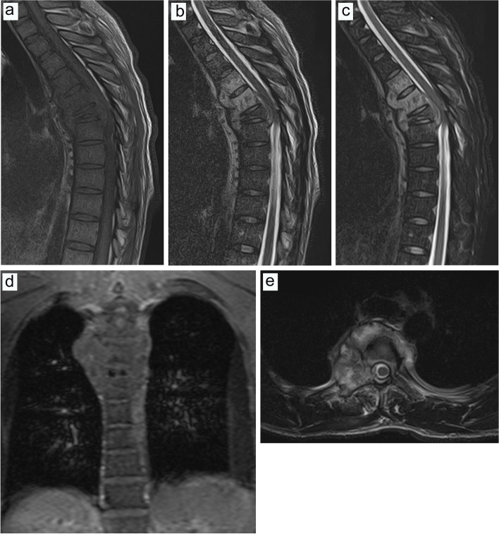 Fig. 12