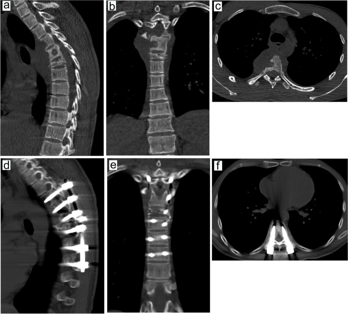 Fig. 11