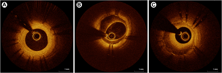 Figure 4